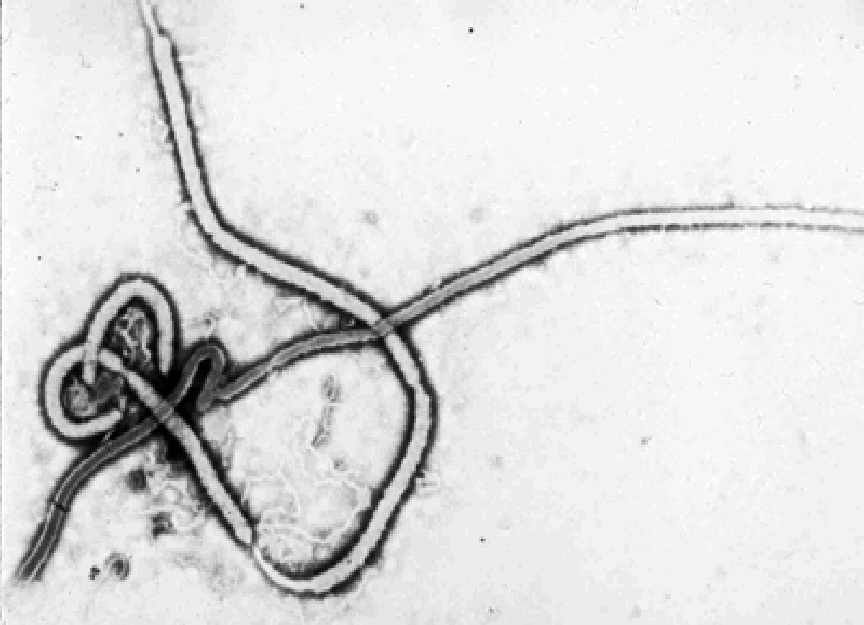 Ebola- virus